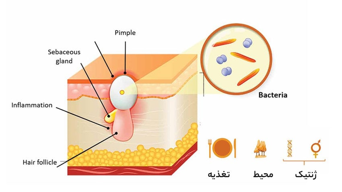 چطور آرایش روزانه را درست و کامل پاک کنیم؟ (جلوگیری از جوش و …